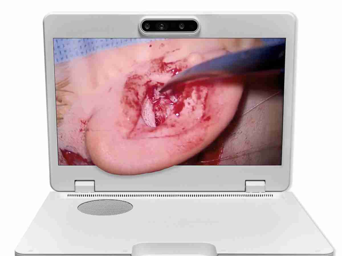 达擎之＂Heads-up 3D显微手术显示系统＂，，，整合4K裸眼3D显示及眼球追踪系统，，具备快速追踪人眼移动位置功能，，减轻医师长时间维持固定姿势的负担，，，，让医师能有更宽广清晰的3D立体视野及更舒适的姿势来执行手术。。。